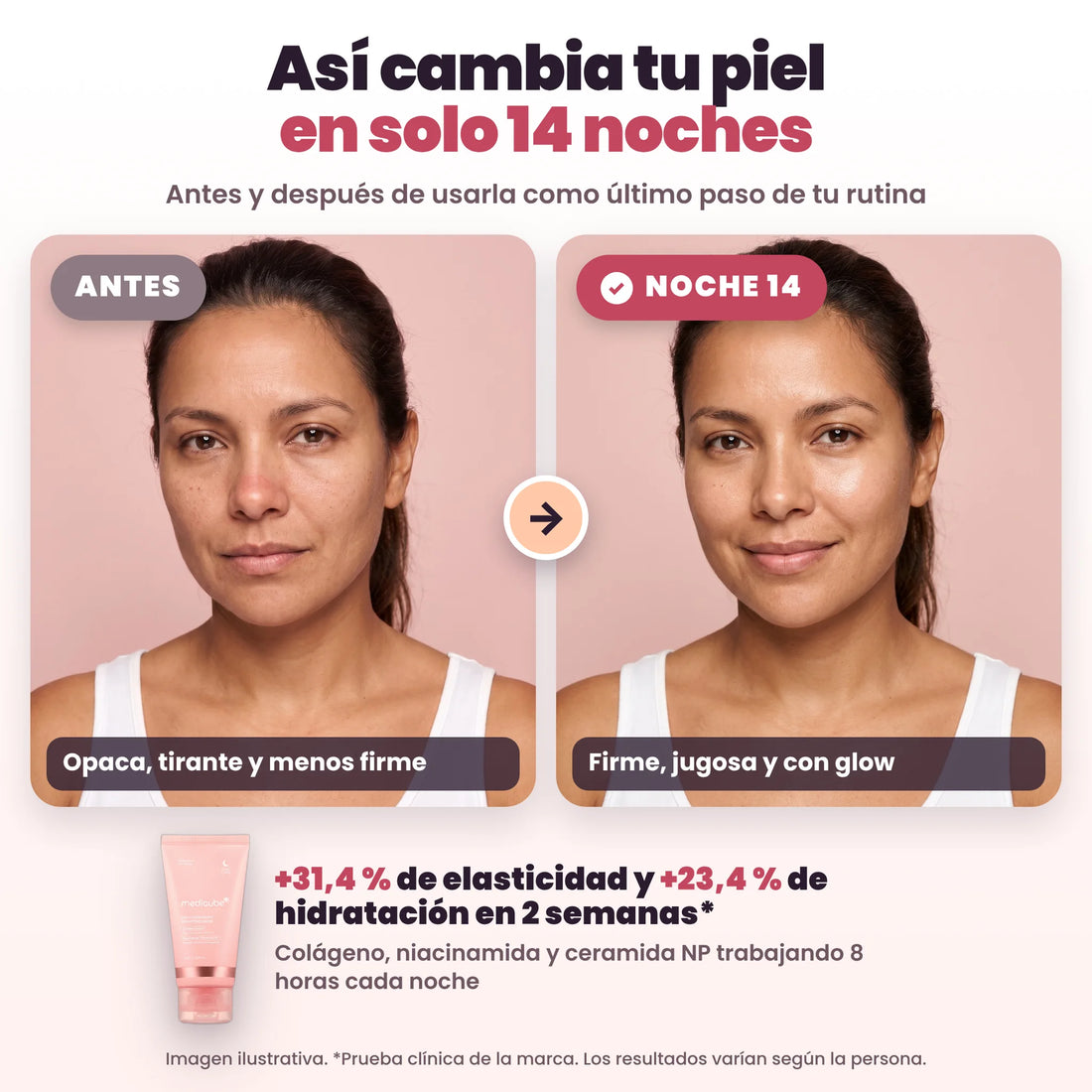 Antes y después de 14 noches con la mascarilla de colágeno para dormir (imagen ilustrativa)