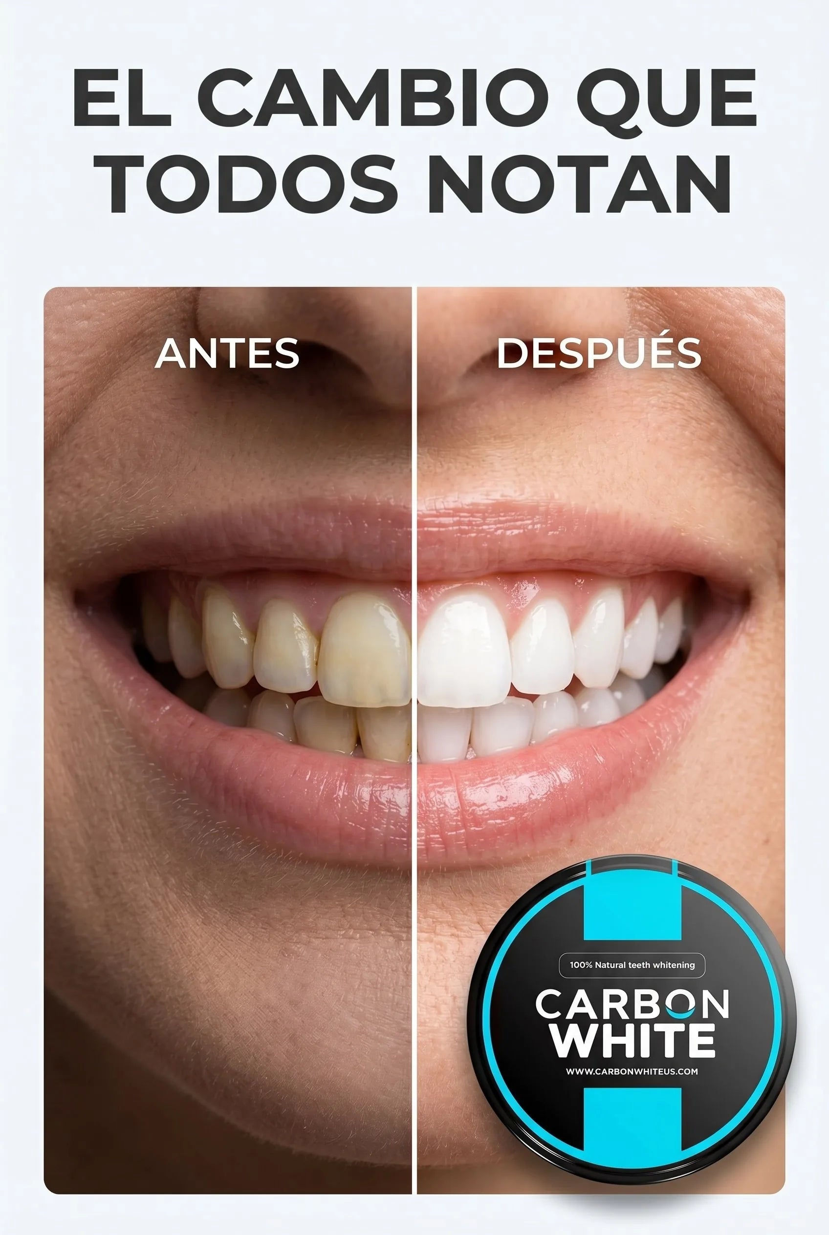 Carbon White - Antes y despues