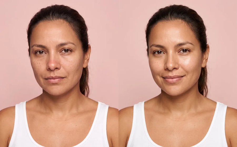 Antes y ahora: piel tirante y deshidratada y luego hidratada
